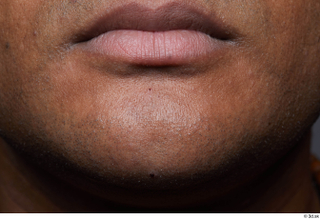 HD Face Skin Kendun Mahlun chin face lips mouth skin…